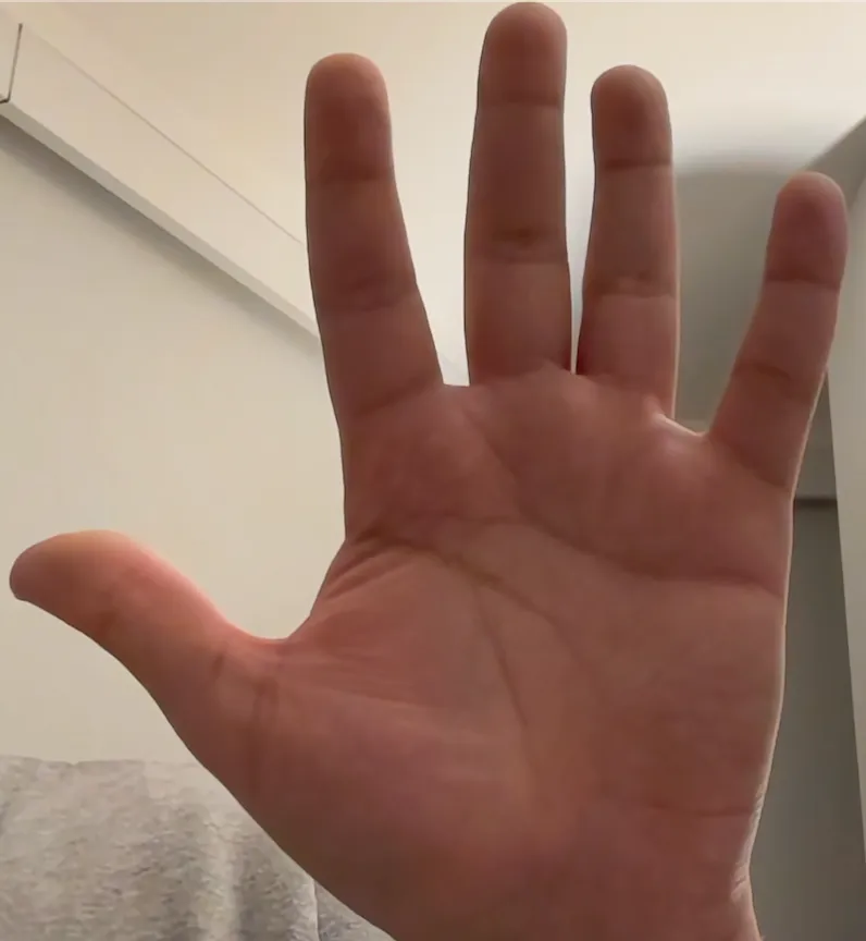 Hand 5