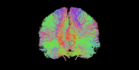 Detecting Brain Regions Associated with Autism Development